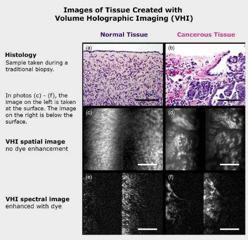 Images of tissue created with volume holographic imaging